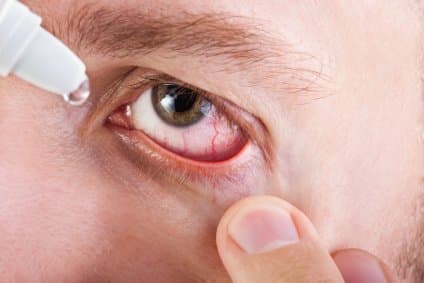 eye care