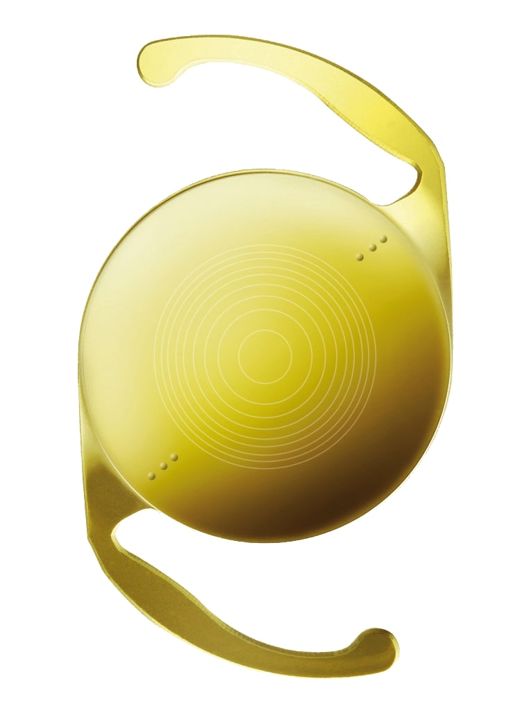 Lifestyle Lens Implant Santa Rosa CA