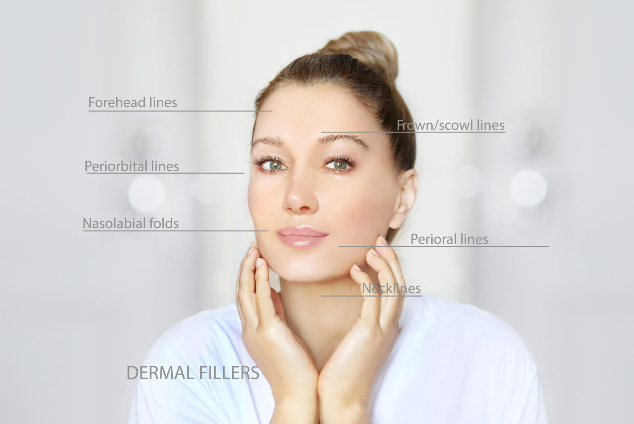 diagram showing where botox can be used on the face